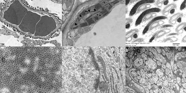 Focus on... Alternatives to Uranyl Acetate