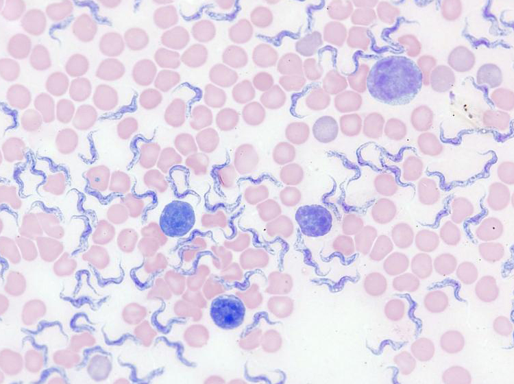 Uncovered blood smear in brightfield Wright staining
