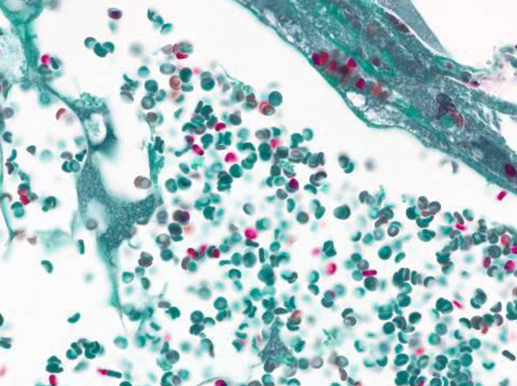 Blood vessels in brightfield Acquired with ZEISS Axiolab 5