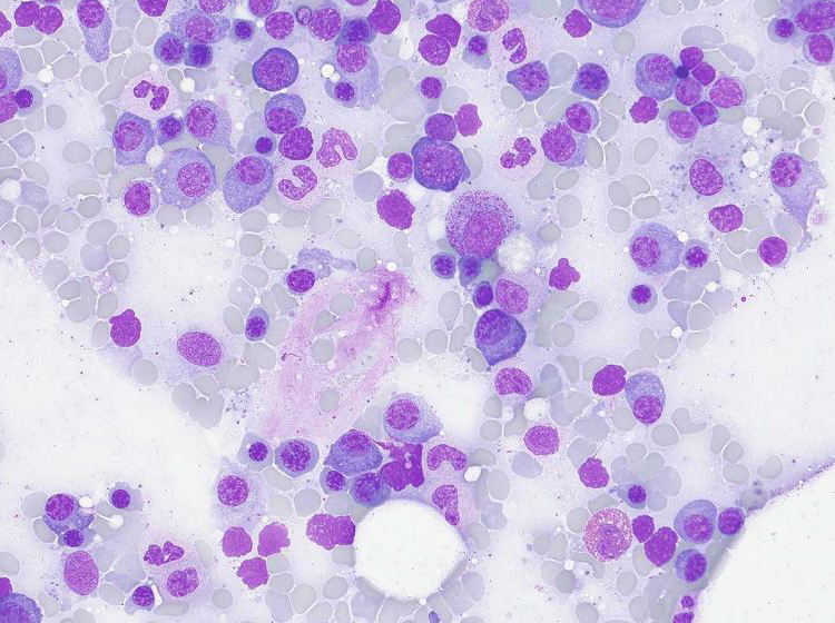 Bone marrow in brightfield Acquired with ZEISS Axioscope 5