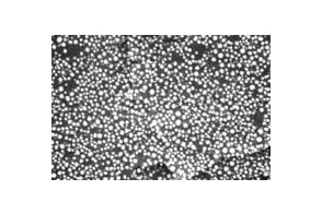 Gold on Carbon Test Standard, very high resolution