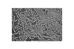 Gold on Carbon Test Standard, ultra high resolution