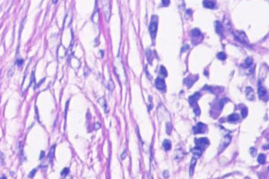 Lung, acquired in brightfield