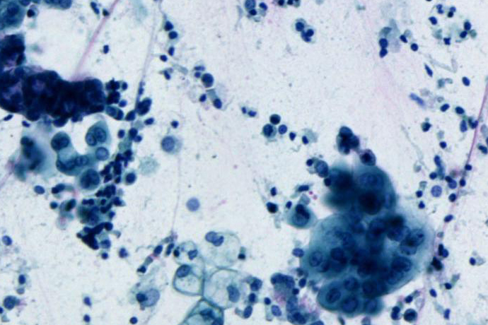 Lung, acquired in brightfield