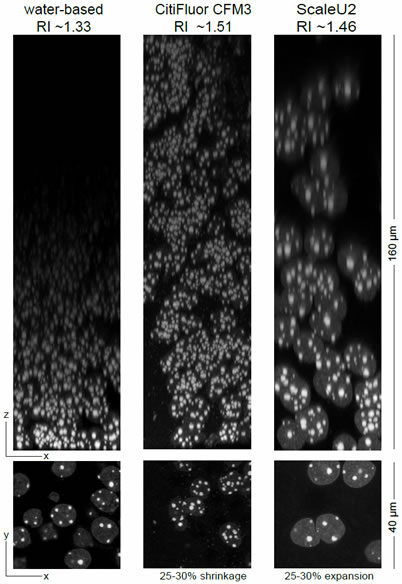 63×1.4 NA PlanApo / 1 Airy / Nyquist sampling xyz / Zeiss LSM 710 Genetically expressed GFP-tagged nuclear protein in brain slice.