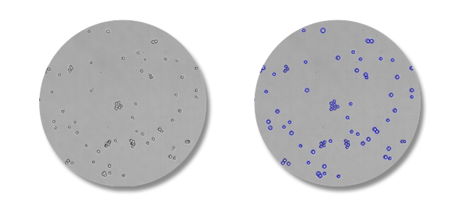 Figure 4. Image of clumped cells counting