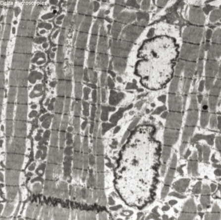 UranyLess - Mouse Cardiac Muscle