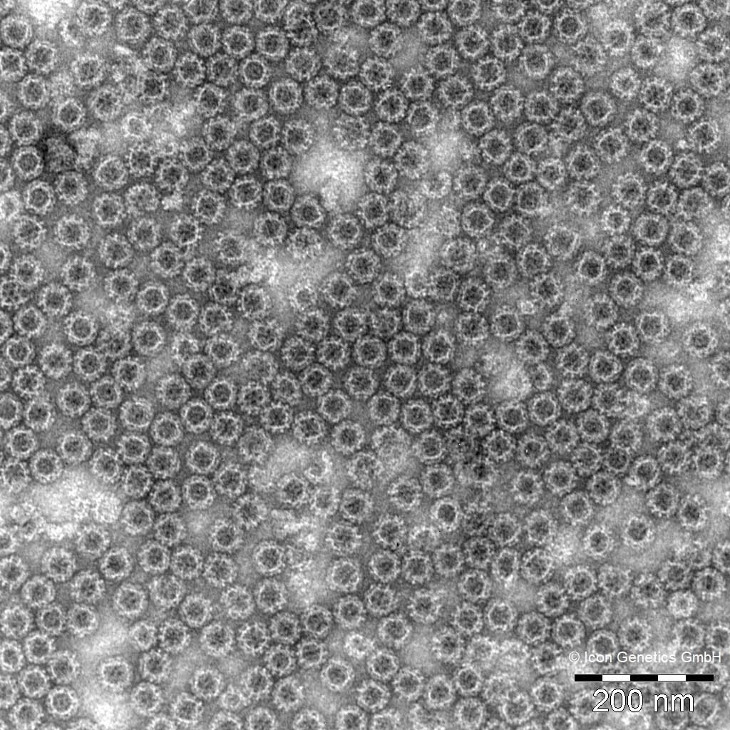 UranyLess -Negative Staining