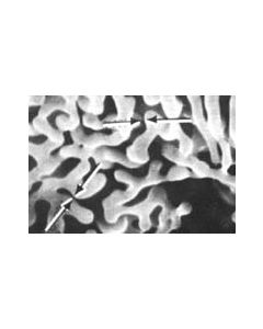 SEM Aluminum-Tungsten Dendrites Test