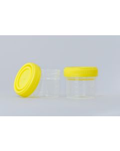 Gewebe Aufbewahrungsbehälter, mit Deckel, 40ml, 200 Stück--4-