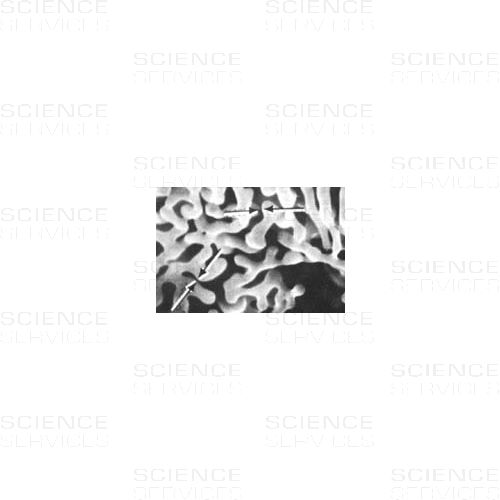 SEM Aluminum-Tungsten Dendrites Test