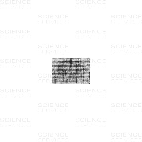 Catalase Crystals on TEM Grid