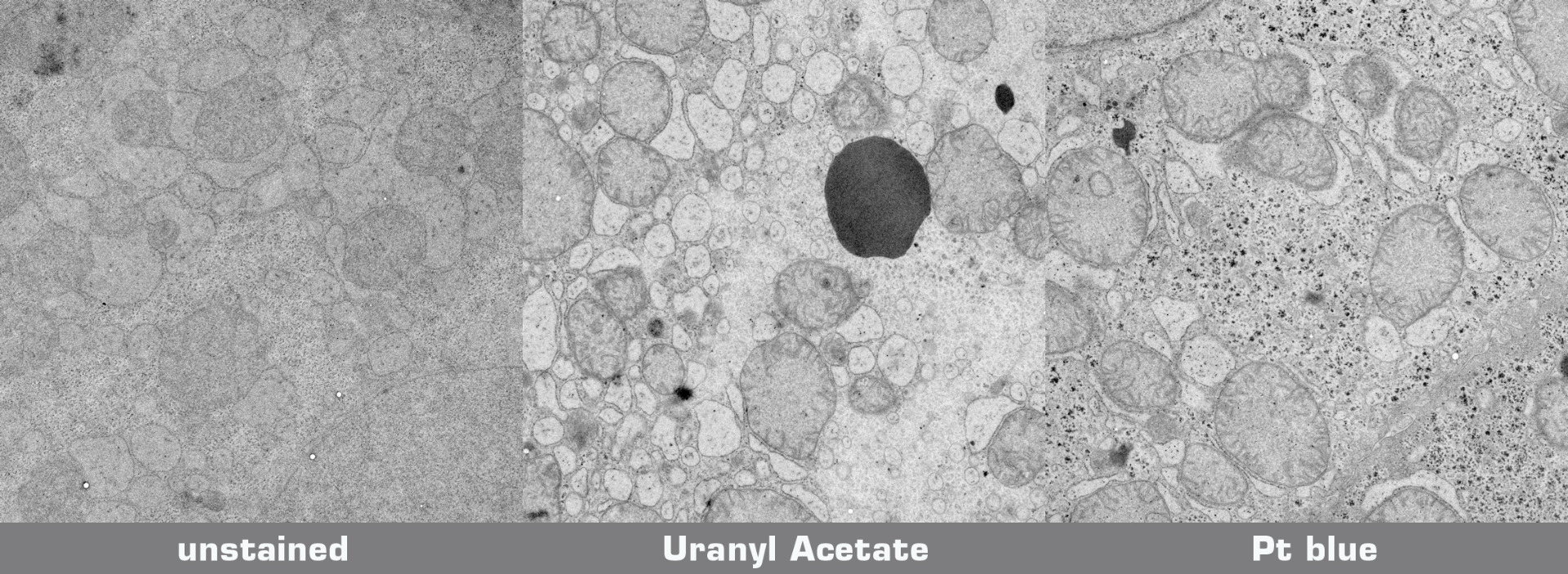 Testprotocol Pt blue vs. Uranyl Acetate Staining Agents for EM